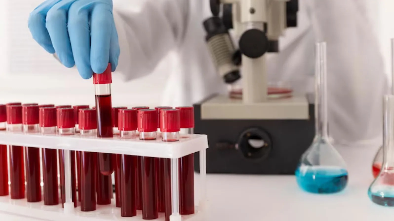 Sürekli Yorgun Musunuz Kansızlık Belirtilerine Dikkat! (1)