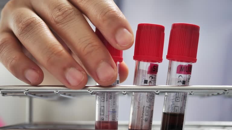 Sürekli Yorgun Musunuz Kansızlık Belirtilerine Dikkat! (2)