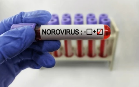 Kış Aylarında Norovirüs Alarmı: Mide Gribi Vakaları Hızla Artıyor