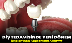 Diş Tedavisinde Yeni Dönem: İmplant SSK Kapsamına Alınıyor