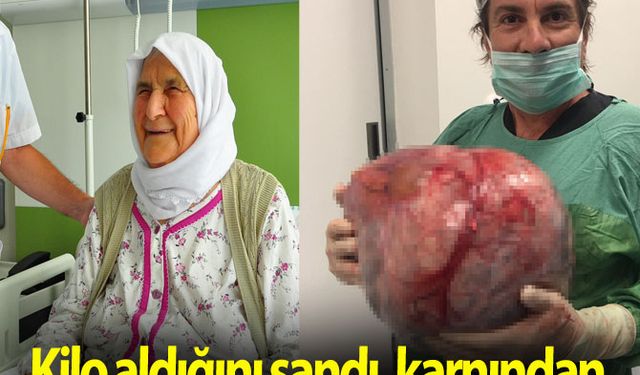 Kilo aldığını sandı, karnından 12 kiloluk kist çıktı 